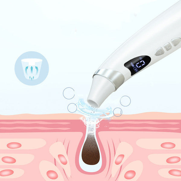 Electric Visual Blackhead Suction Instrument Household Cleansing Pore Cleaner For Skin Equipment Skin Care Tool-Diamond Deluxe Outlet